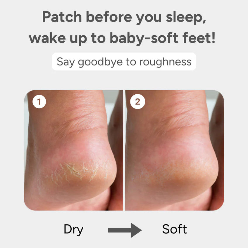 Baren Shea Butter Sleeping Heel Patch