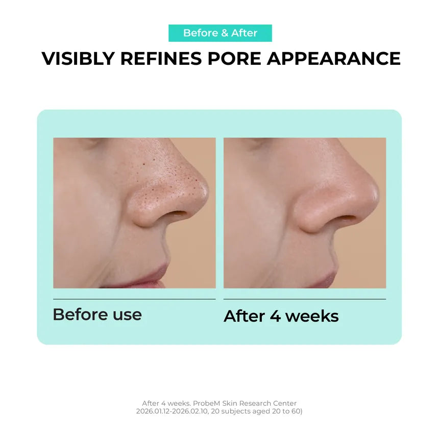 Jumiso Overnight Zero Pore Nose Patch