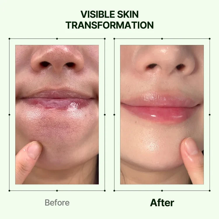 Skin transformation before-and-after close-up with hands touching lips