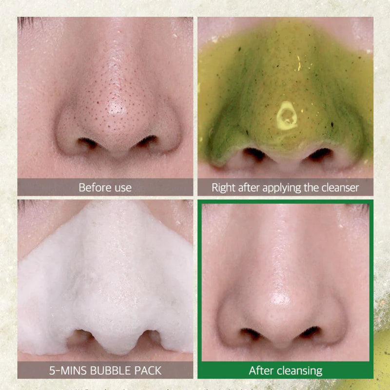 Some By Mi Bye Bye Blackhead 30 Days Miracle Green Tea Tox Bubble Cleanser