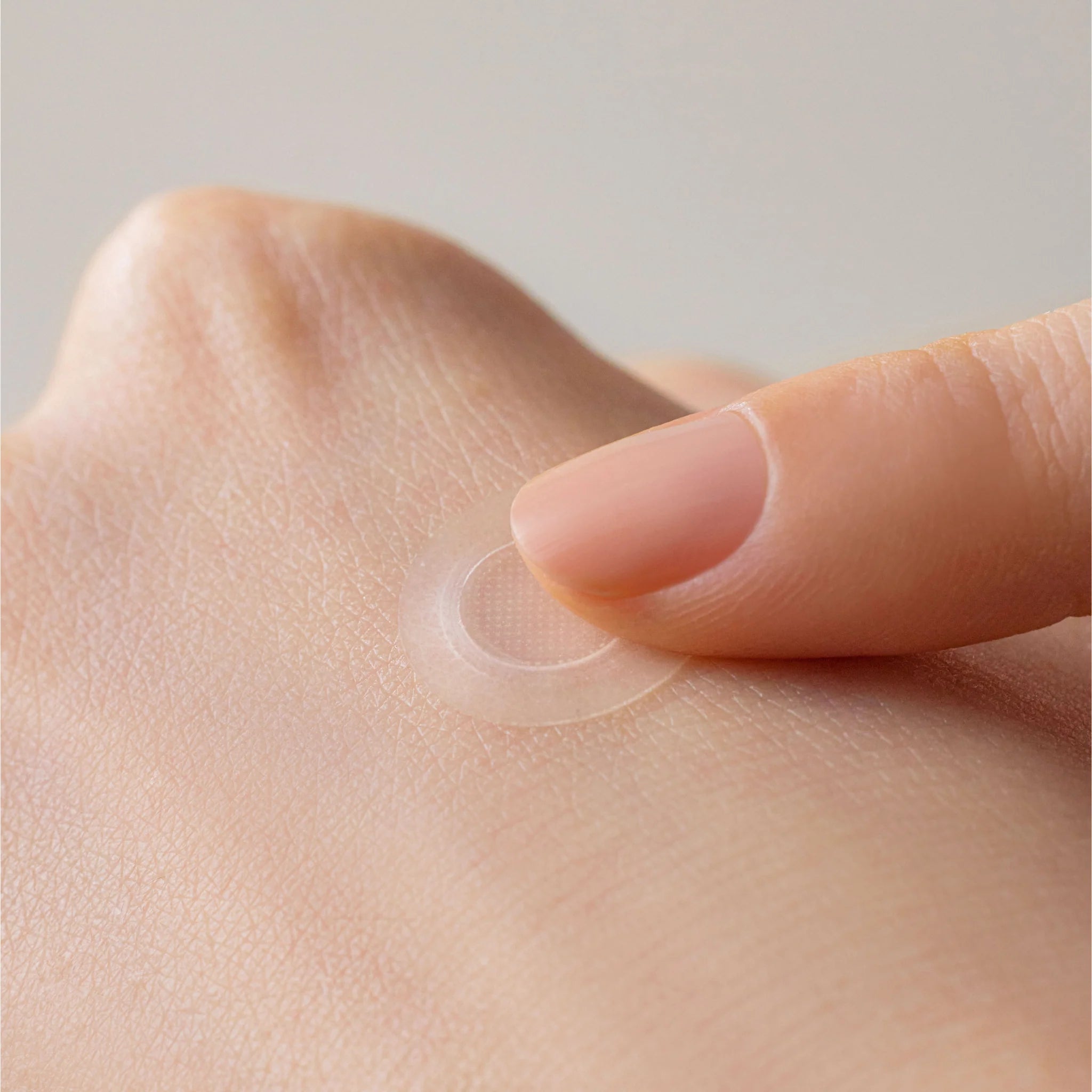 SOME BY MI Micro Pin Spot Patch