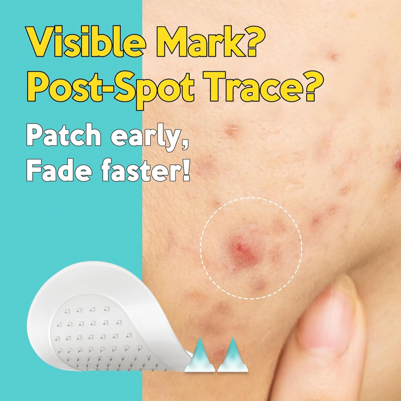 Troubless Micro-Point Patch Plus Vitamin C 10% For Dark Spot