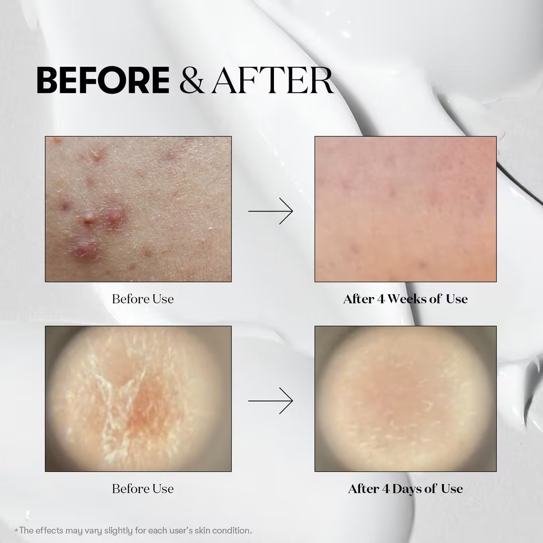 VT Cosmetics Reedle Shot Starter Stick Kit