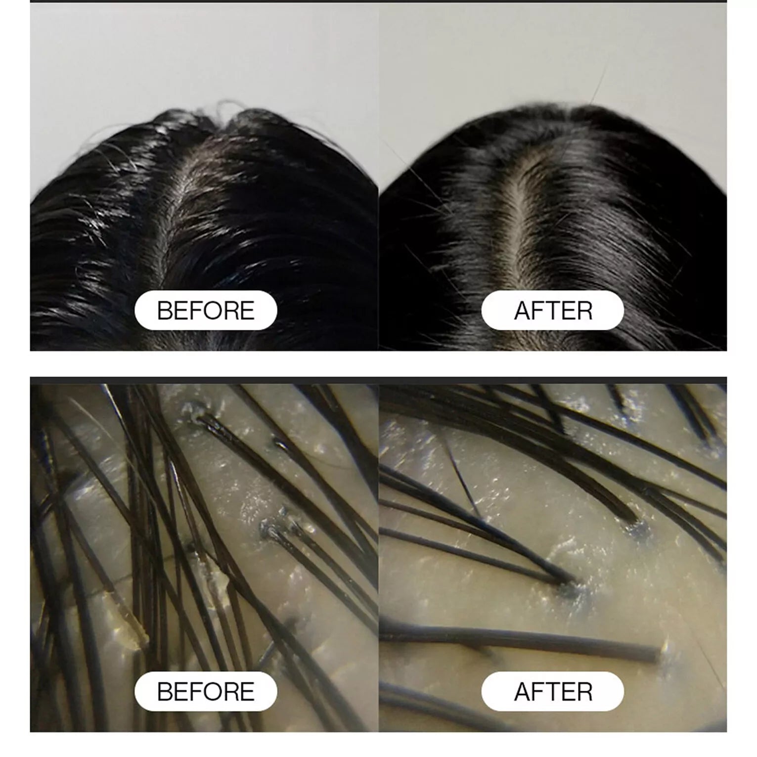 GROWUS Sea Salt Therapy Scalp Scaler