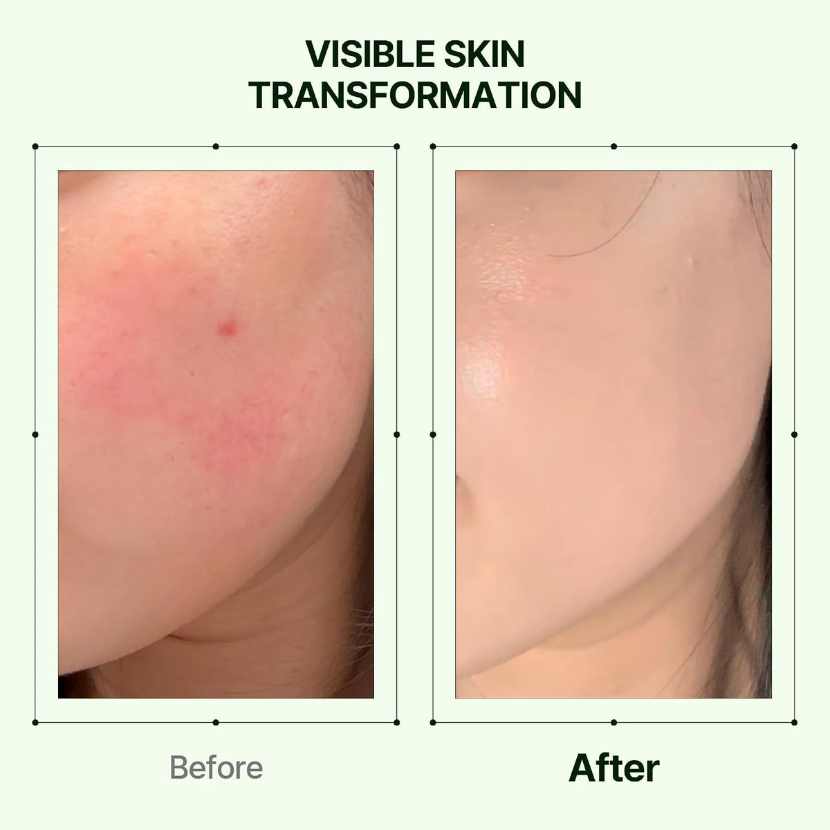 Skin before-and-after panels showing clearer texture from moisturizer application