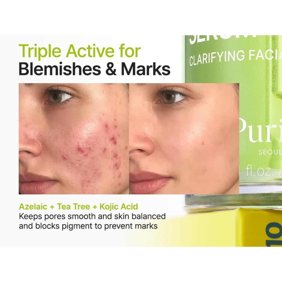 Purito Seoul Azelaic Acid 10 Kojic Tea Tree Serum