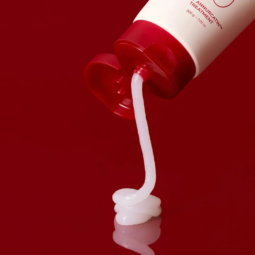 moev Annurcatin Treatment
